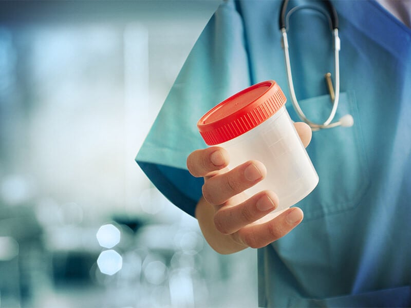 urine cup for drug testing