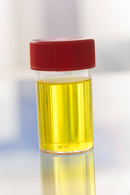 urine drug testing sample