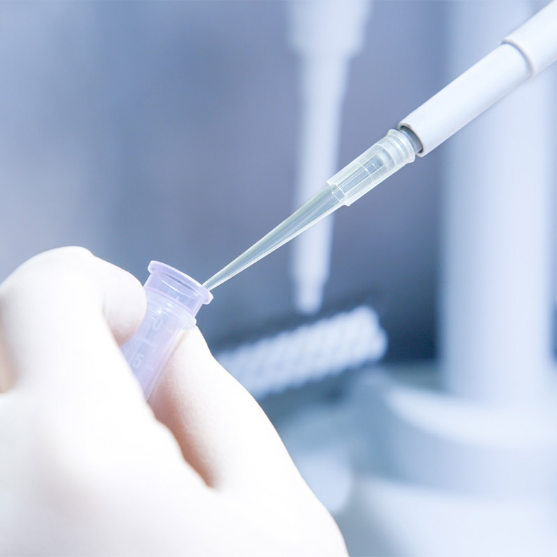 Urine Testing