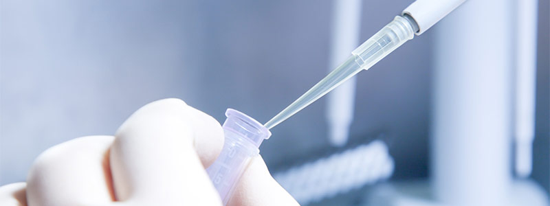 Urine Drug Testing